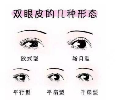 徐州二院双眼皮案例