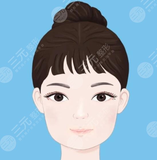 徐州二院双眼皮