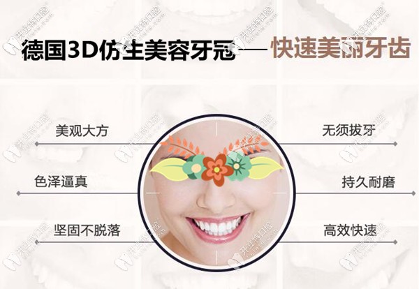 德国3D仿生美容牙冠