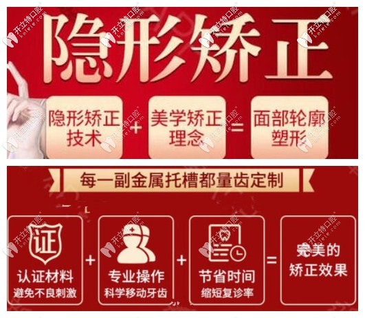 金属托槽矫正及全隐形矫正的优势