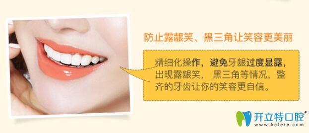 防止牙齿矫正过程中的露龈笑、黑三角