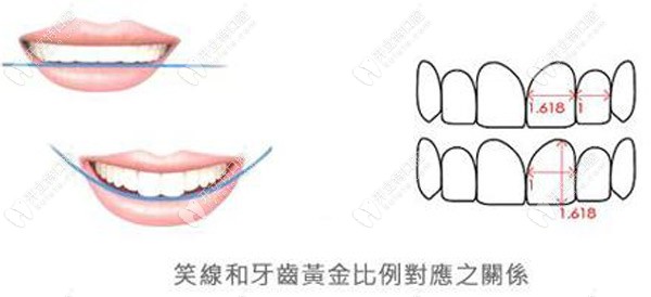 笑线和牙齿的黄金比例对应之关系