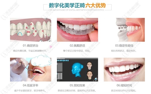 同道口腔的数字化正畸