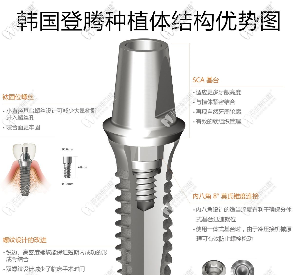 登腾种植体优势图