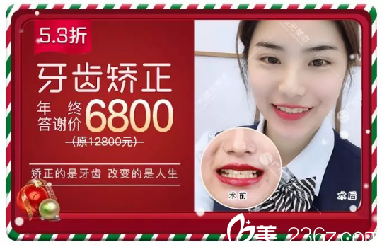 广州曙光口腔医院牙齿矫正费用6800元