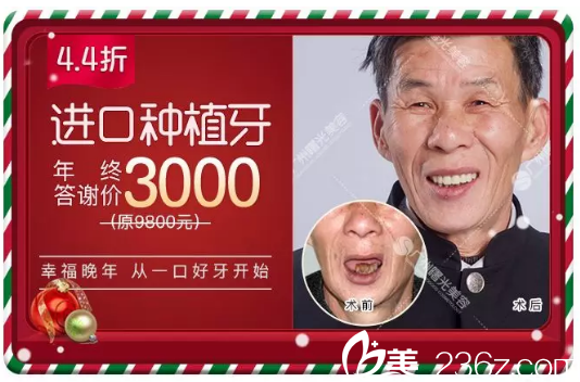 广州曙光口腔科种植牙3000元附案例