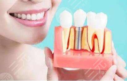牙齿种植效果