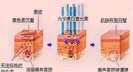 激光美容类项目科