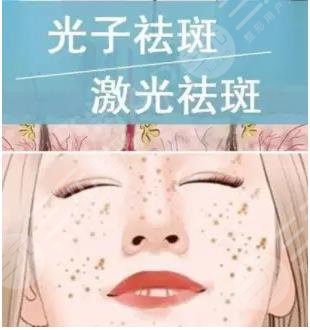 激光祛斑，光子祛斑
