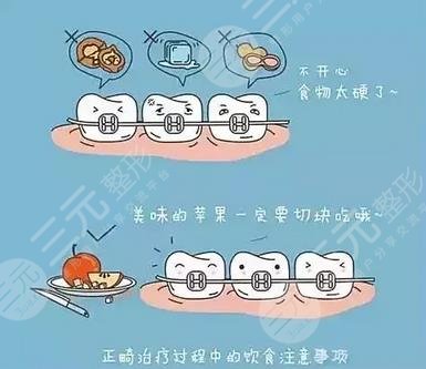 牙齿种植饮食问题