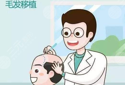广州植发的价格一般是多少