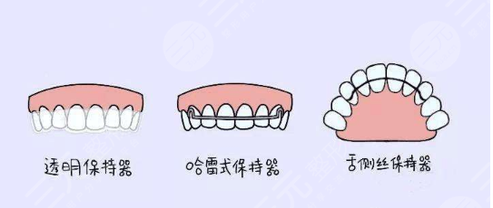 华西口腔项目科普