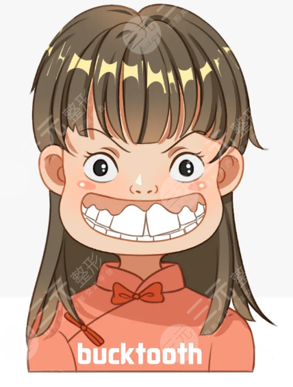 牙齿矫正案例