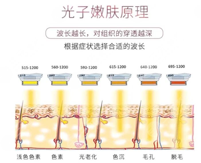 无锡第二人民医院光子嫩肤案例