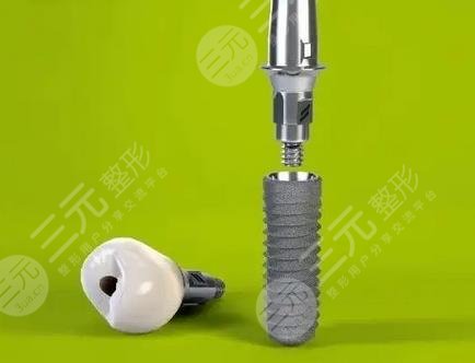 邯郸三院种植牙成功案例