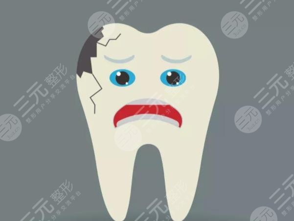 补牙多少钱一颗牙？补牙齿一般要多少钱？附价目表