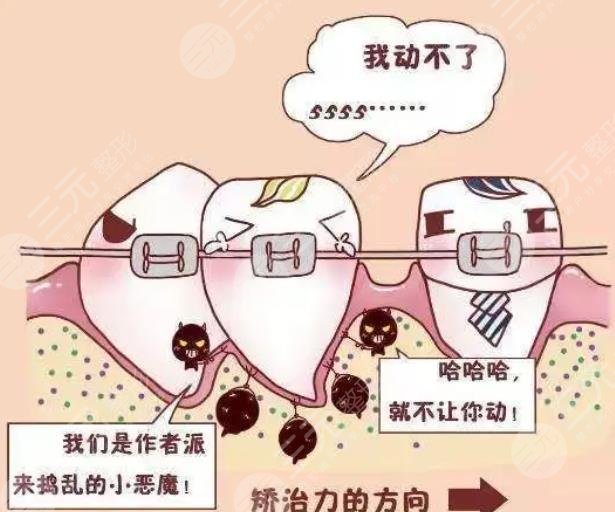 牙齿矫正