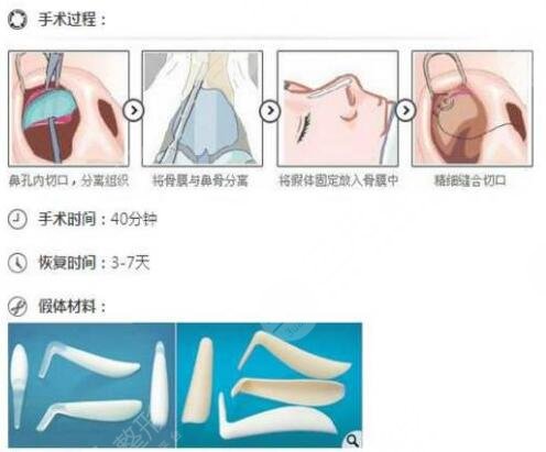 手术后3个月