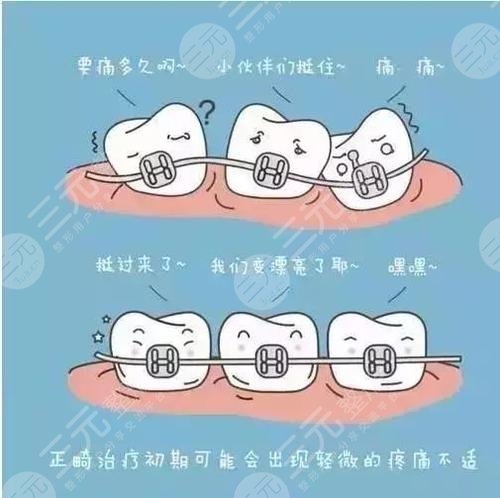 进口托槽矫正牙齿优缺点：