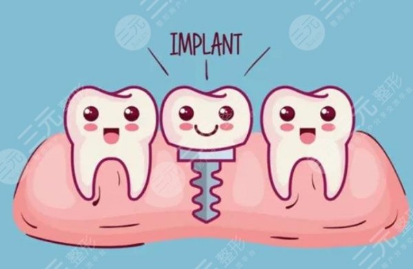 2023种植牙收费价目表大曝光，了解清楚不踩雷！