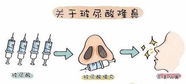 杭州美莱医疗美容医院做鼻子怎么样？