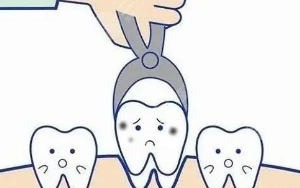 拔牙的操作流程