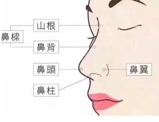 协和龙飞鼻整形要多少钱？贵不贵？案例效果赞不绝口-城市惠