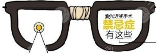 全飞秒激光手术