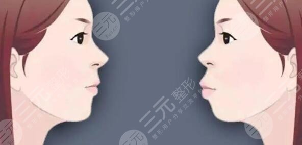 上海第九人民医院正颌正畸案例