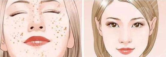 广州医科大学附属第二医院美容科祛斑