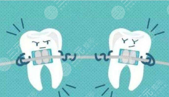 广州华侨医院牙齿矫正案例