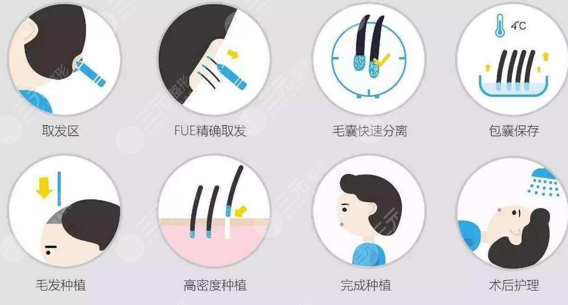 北京大学深圳医院植发案例
