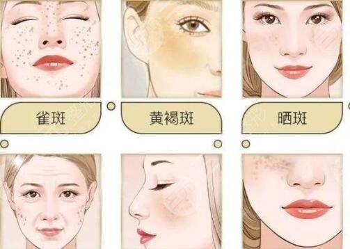 广州医科大学附属第一医院祛斑