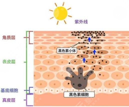 广州医科大学附属第一医院祛斑案例
