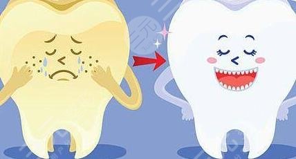 牙齿美白案例果分享
