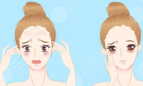 大拉皮手术能维持多久大概多少钱?网友体验后回答拉皮果真相!