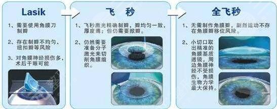 爱尔眼科医院做近视手术价格