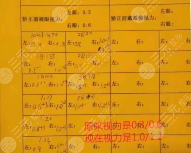 长沙爱尔眼科医院近视矫正案例