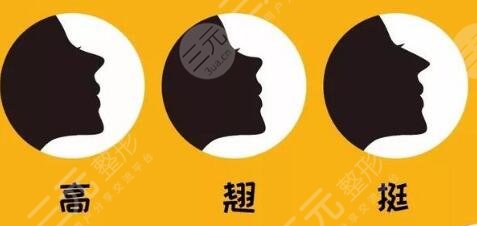 上海百*丽隆鼻案例