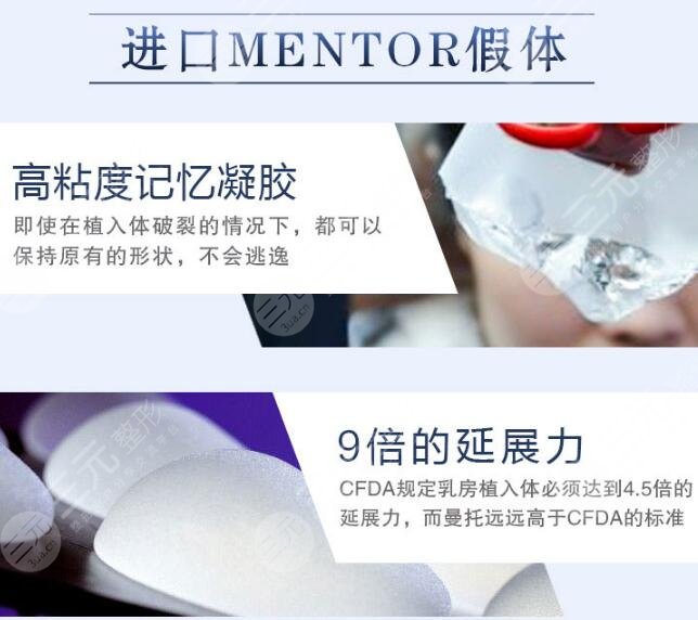 曼托隆胸假体