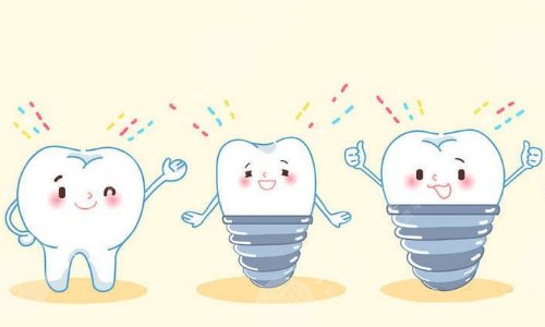 牙椅怎么介绍美奥口腔医院种植牙价格是多少一颗？种植牙技术怎么样？答案在这篇！_https://www.jmylbn.com_新闻资讯_第4张