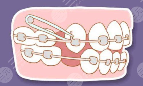 牙椅怎么介绍美奥口腔医院种植牙价格是多少一颗？种植牙技术怎么样？答案在这篇！_https://www.jmylbn.com_新闻资讯_第5张