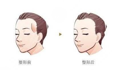 济南艺星做脂肪填充果反馈