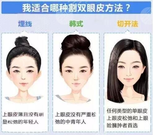 广州南方医院双眼皮价格收费高吗