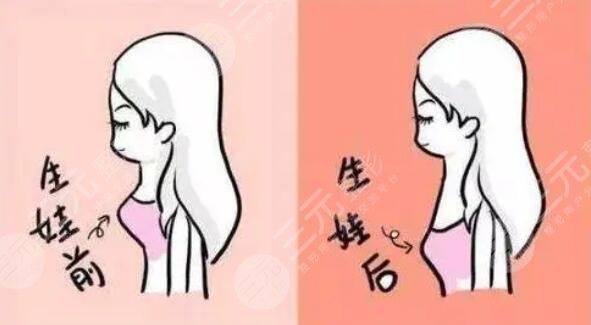 北京八大处乳房下垂矫正案例