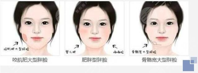金一医生的4D三维正颌手术有什么优势?
