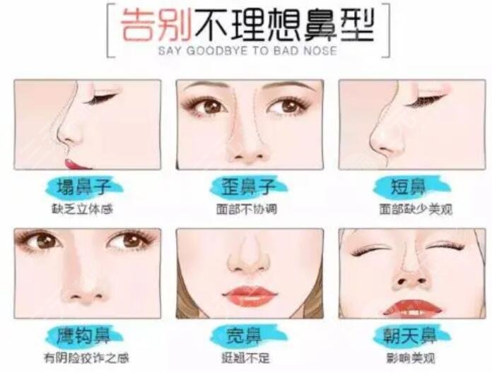 北京八大处鼻整形项目科普