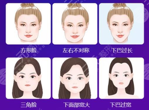 上海首尔丽格磨骨项目案例体验反馈: