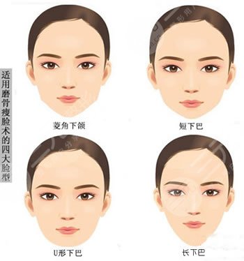 上海首尔丽格崔荣达医生磨骨案例展示