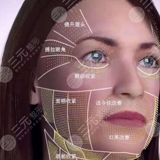 八大处拉皮除皱手术案例